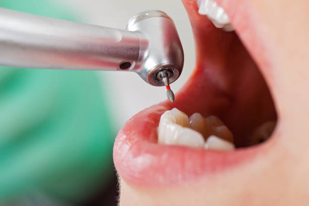 Best Tooth Infection Emergency Dentist  in Oill, NE